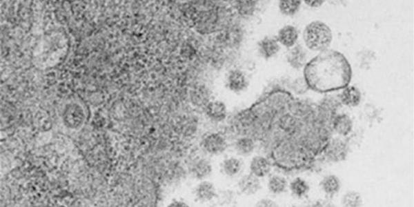 Virus del SARS-CoV-2 saliendo de las células infectadas 